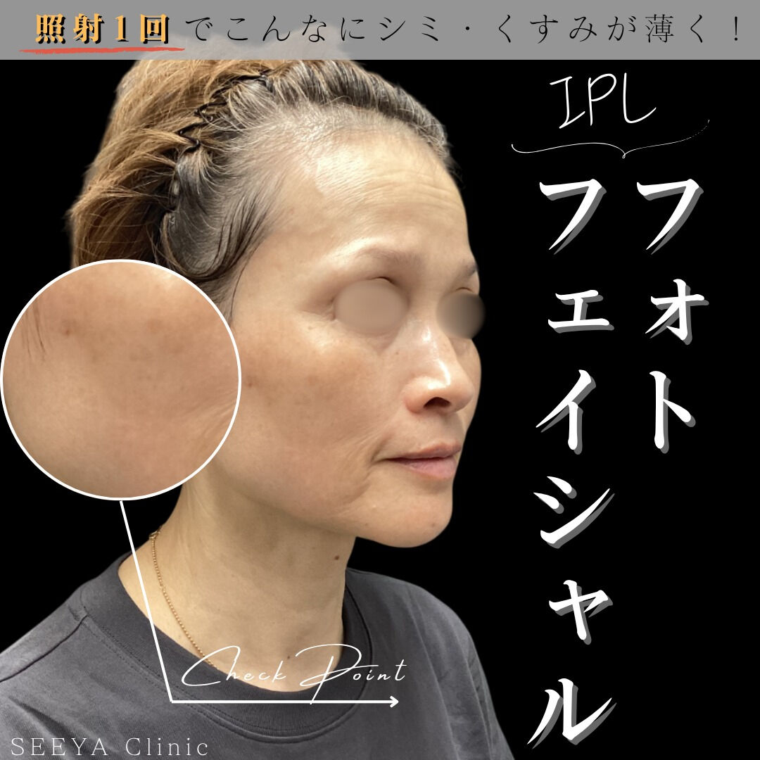 【肌にやさしく美肌へ】