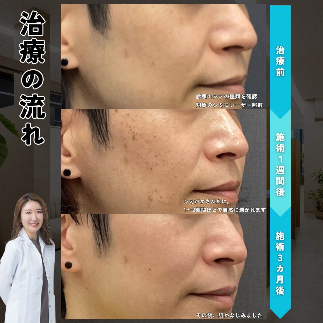 はじめてでも安心