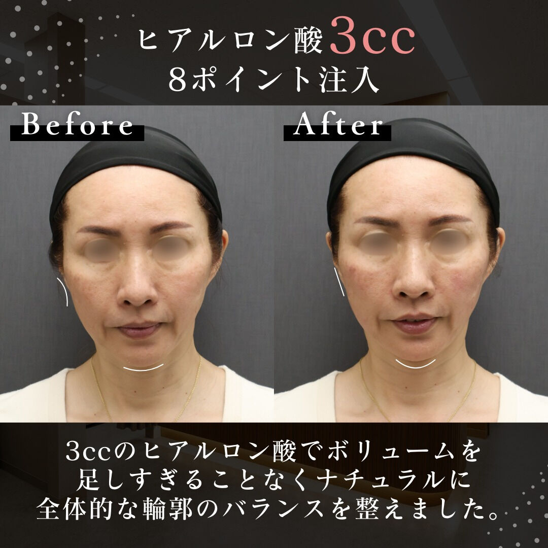 バランスを重視した精密な施術