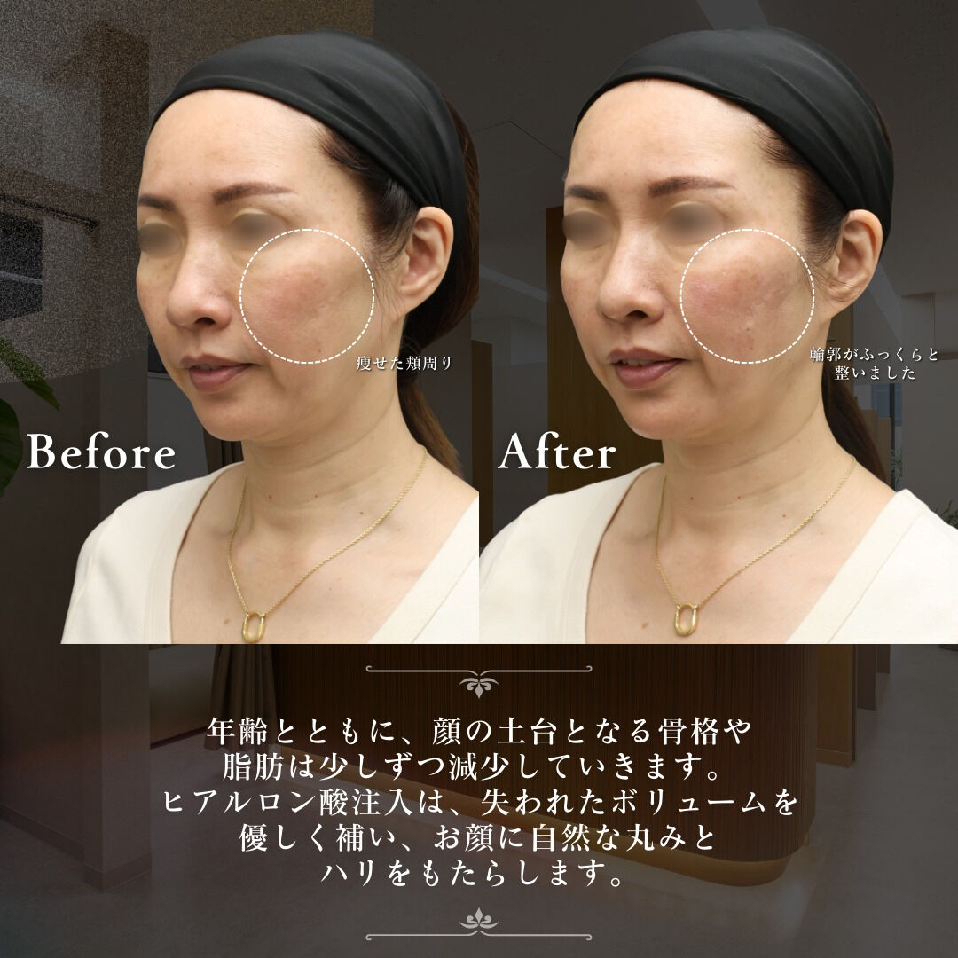 バランスを重視した精密な施術