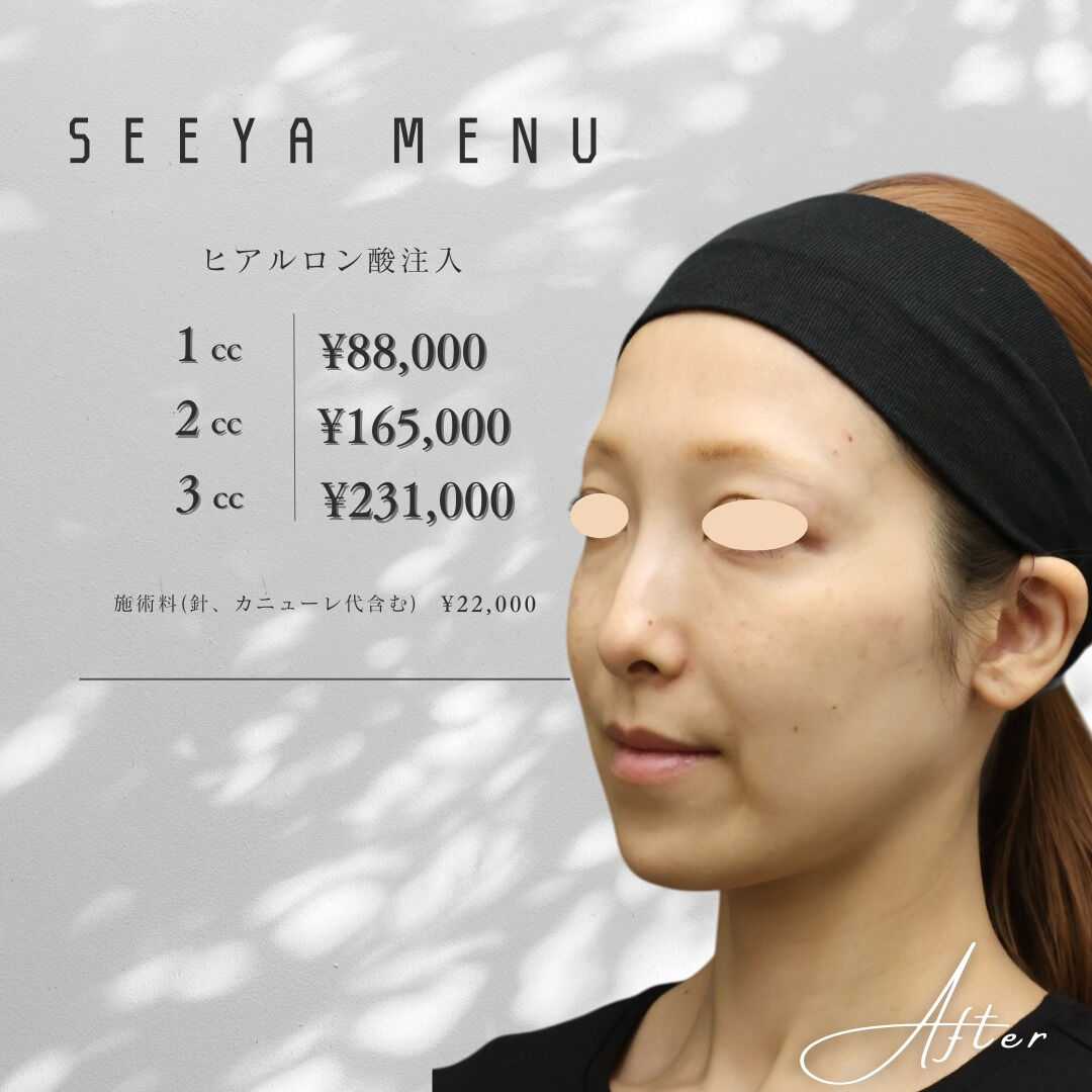 「最近、頬やフェイスラインのたるみが気になる…」