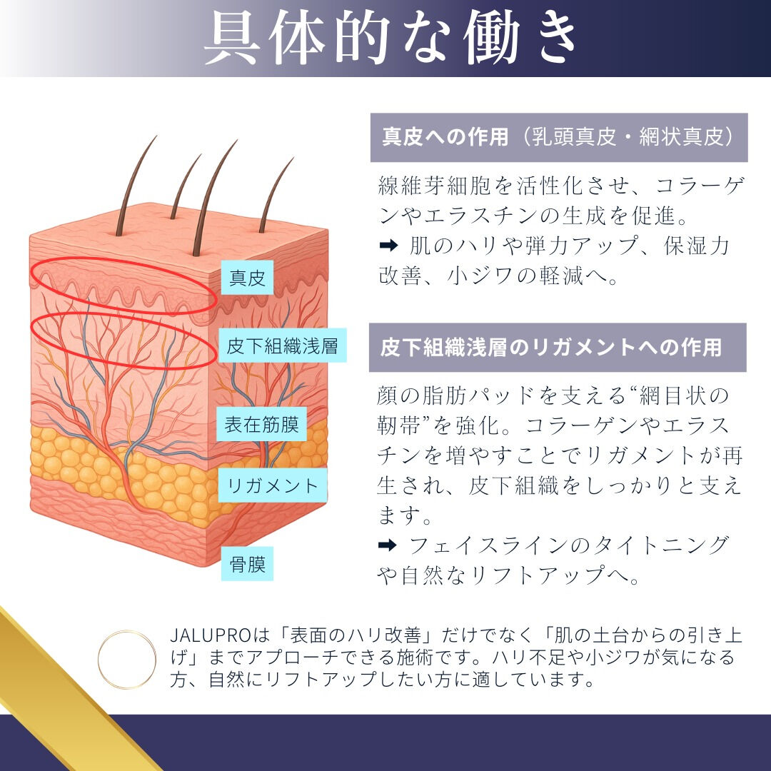 『 JALUPRO SUPER HYDRO💉』