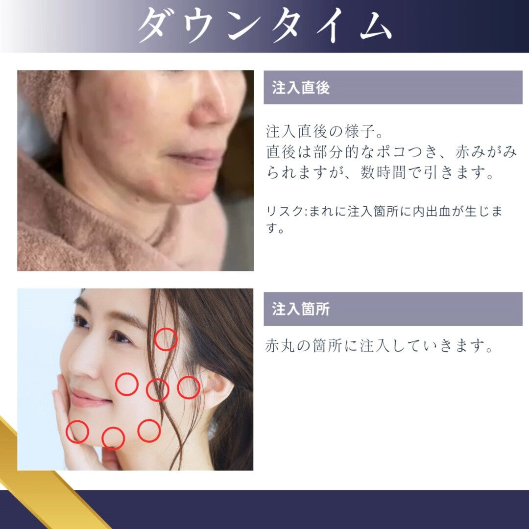 『 JALUPRO SUPER HYDRO💉』