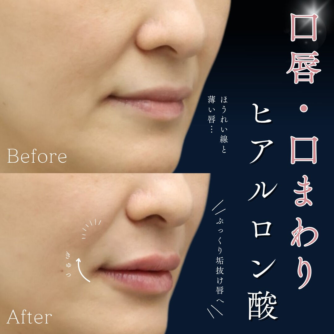 💎 品のある美しさは口元から