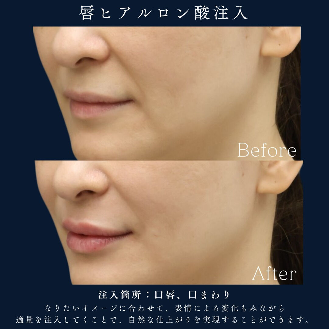 💎 品のある美しさは口元から