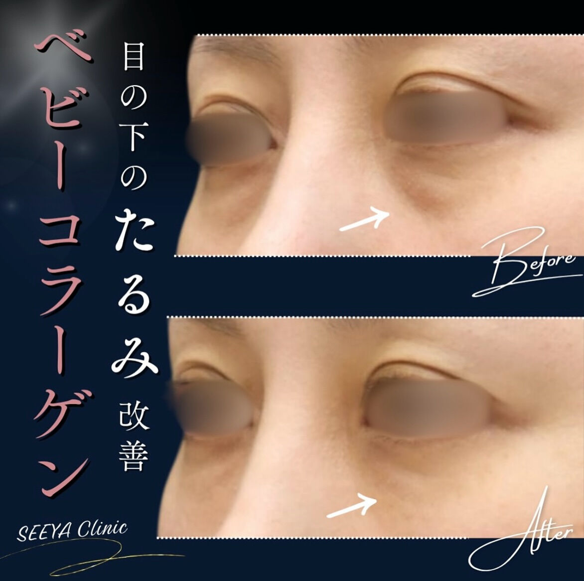 ✨ベビーコラーゲンの魅力✨