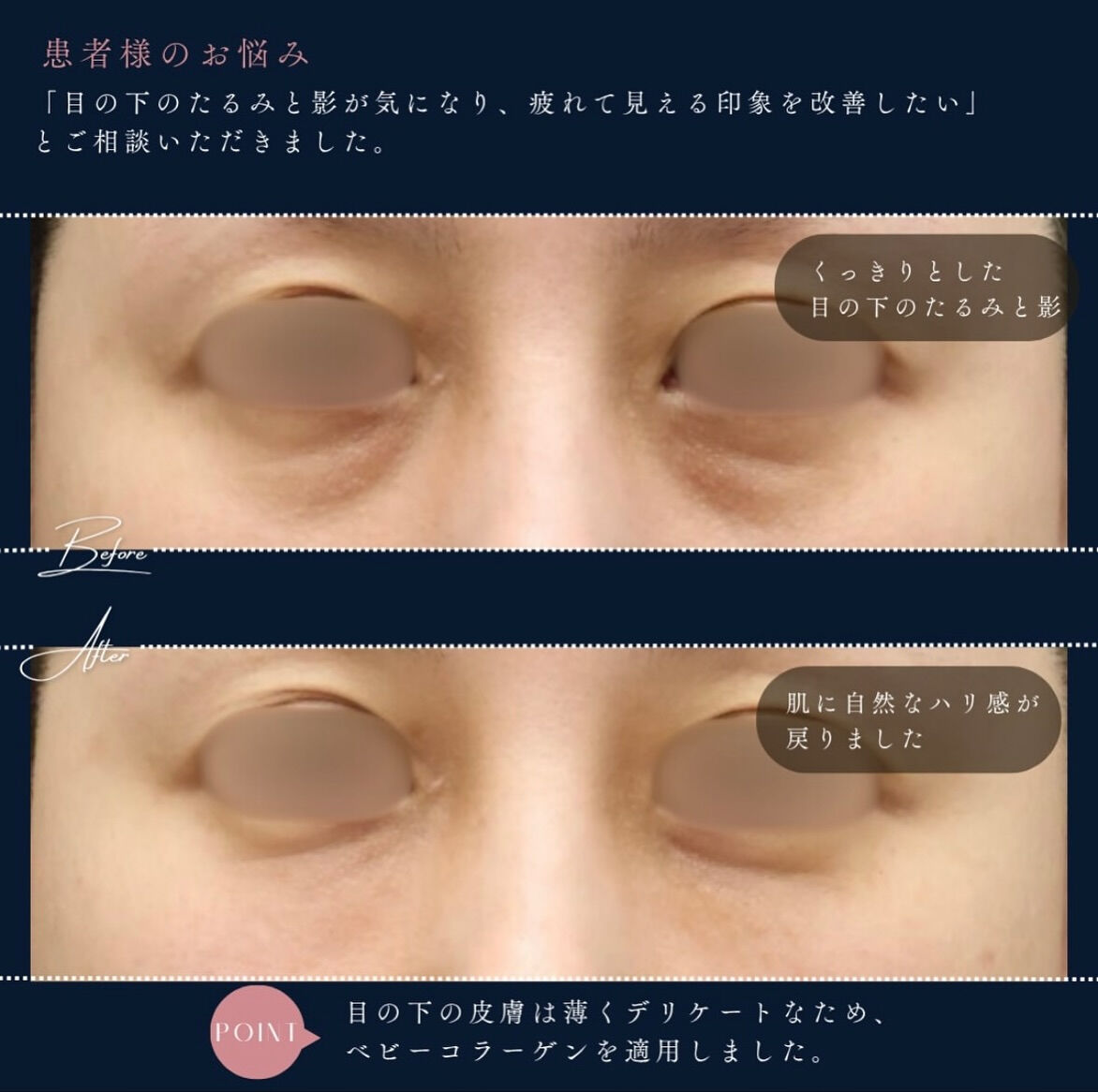 ✨ベビーコラーゲンの魅力✨