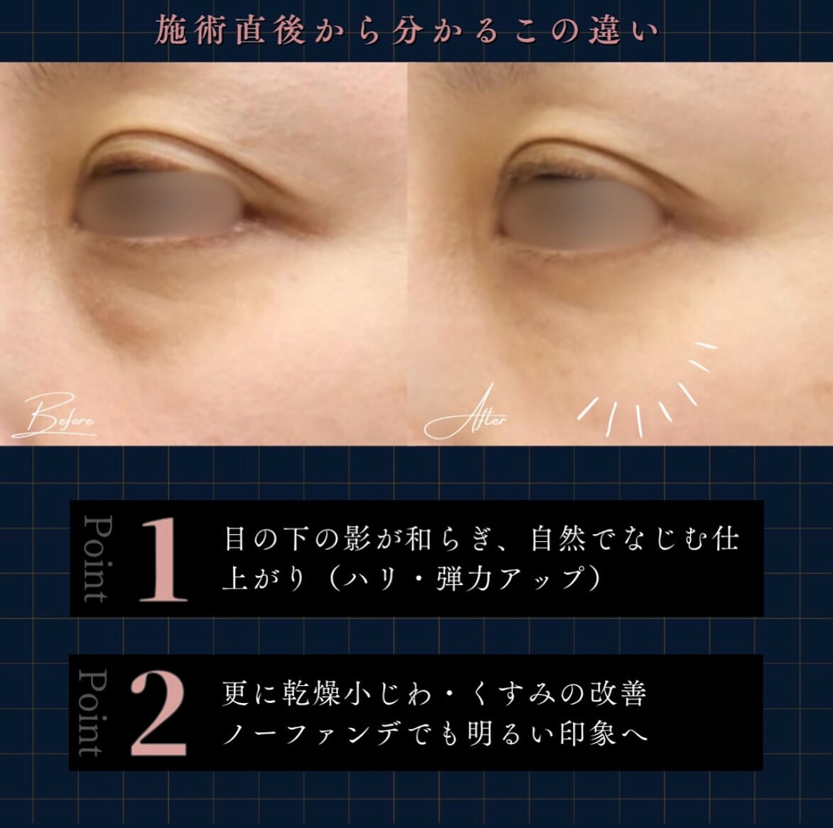 ✨ベビーコラーゲンの魅力✨