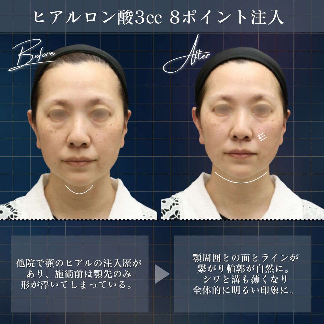 💉 土台から整える、品格ある若返り