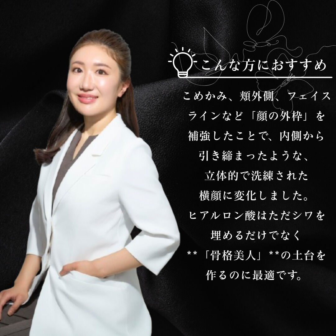 輪郭スッキリ✨ヒアルロン酸で顔の外枠をデザイン！