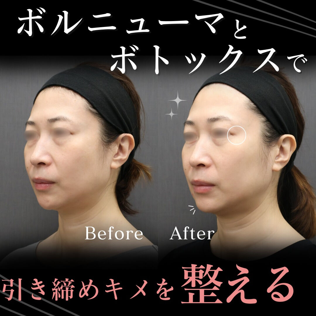 凛とした輪郭が、品格を宿す