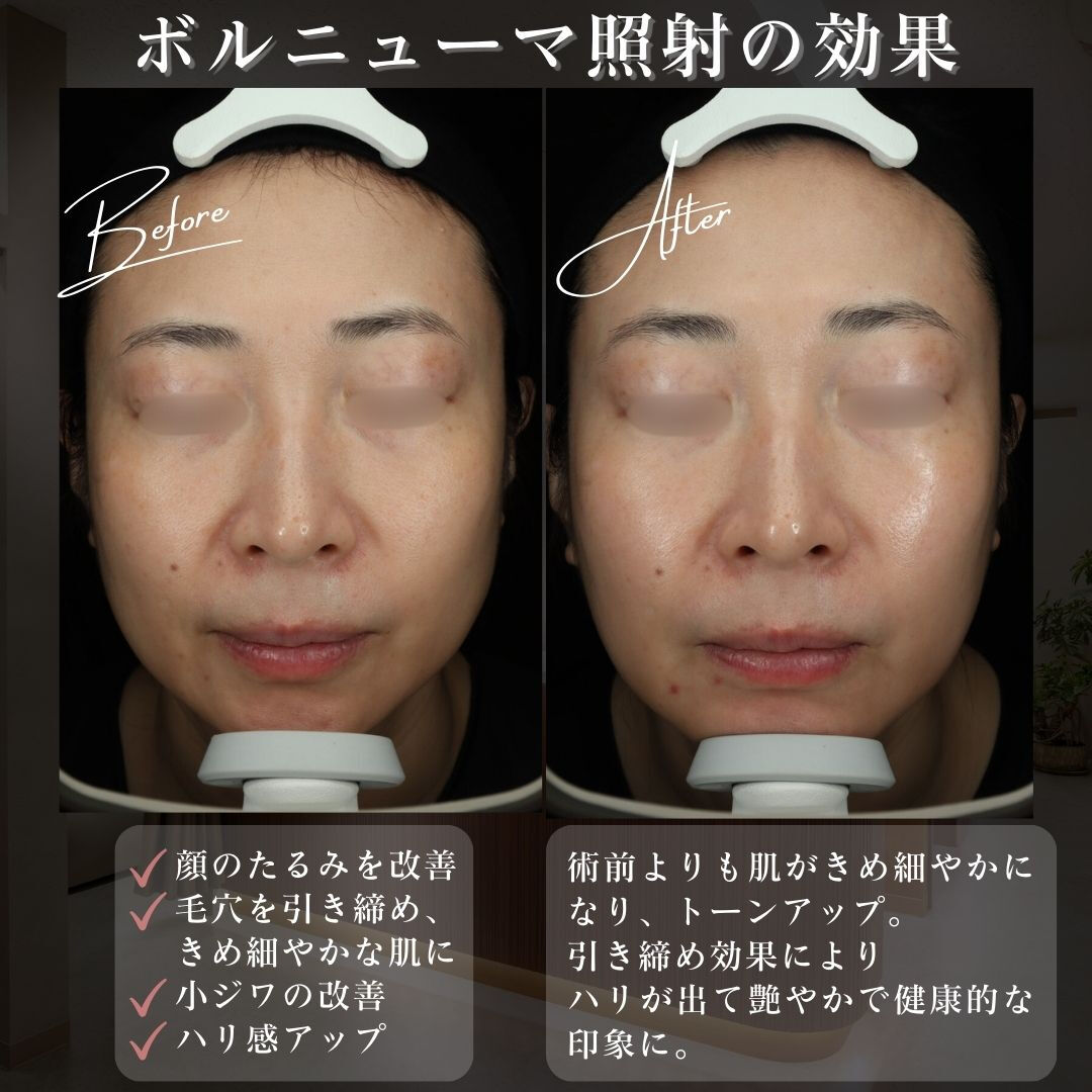 凛とした輪郭が、品格を宿す