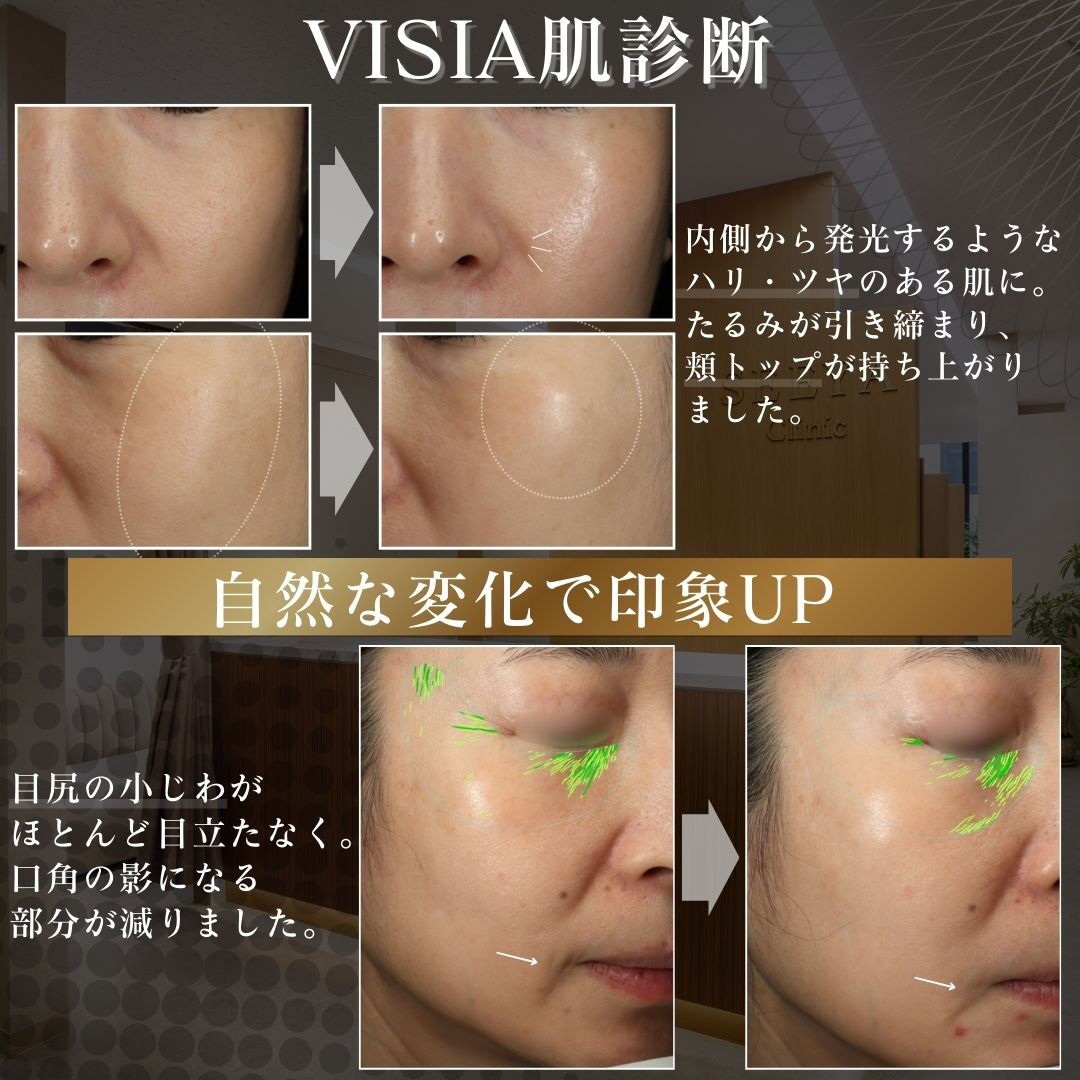 凛とした輪郭が、品格を宿す